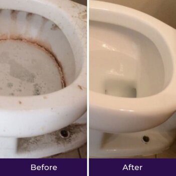 NuroClean image